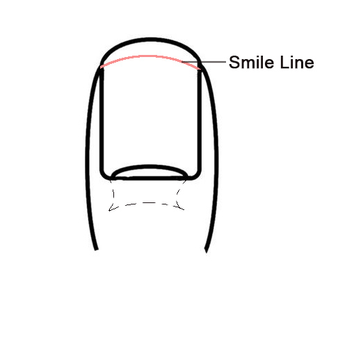position of smile line